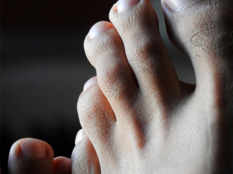 Tratamiento pie diabetico