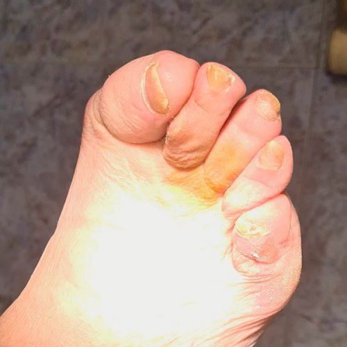 Podología geriátrica Oviedo