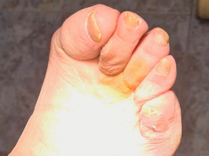 Podologia geriatrica Oviedo